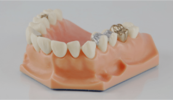 image of dental crowns on fake jaw