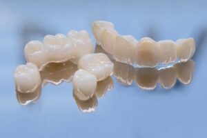 Close-up of several dental crowns and bridges